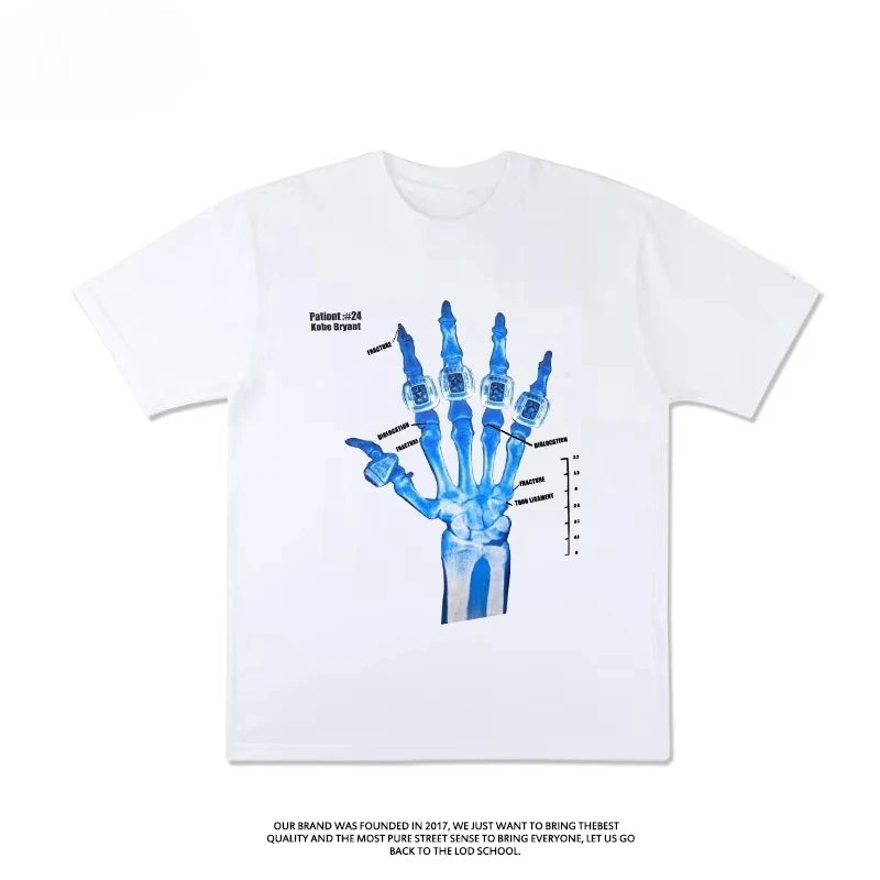 Lakers Kobe Bryant Five Crowns Finger Injury Commemorative T-shirt Short Sleeved Jersey Sports Men's  2025 Loose Top Tee Summer